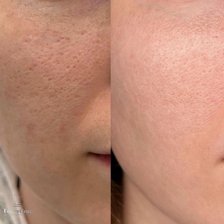 Mascarilla Joseon Brilla en 15 minutos