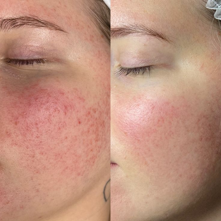 Crema Arencia Limpieza profunda, frescura total
