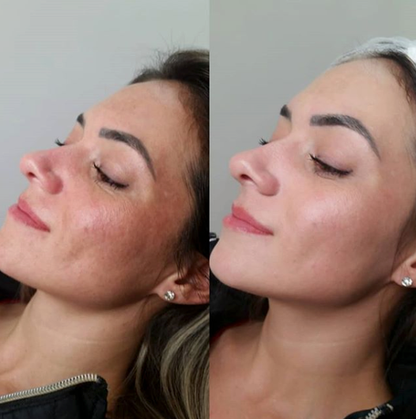 Retinal Booster Transforma tu piel con la nueva generación de retinol y colágeno