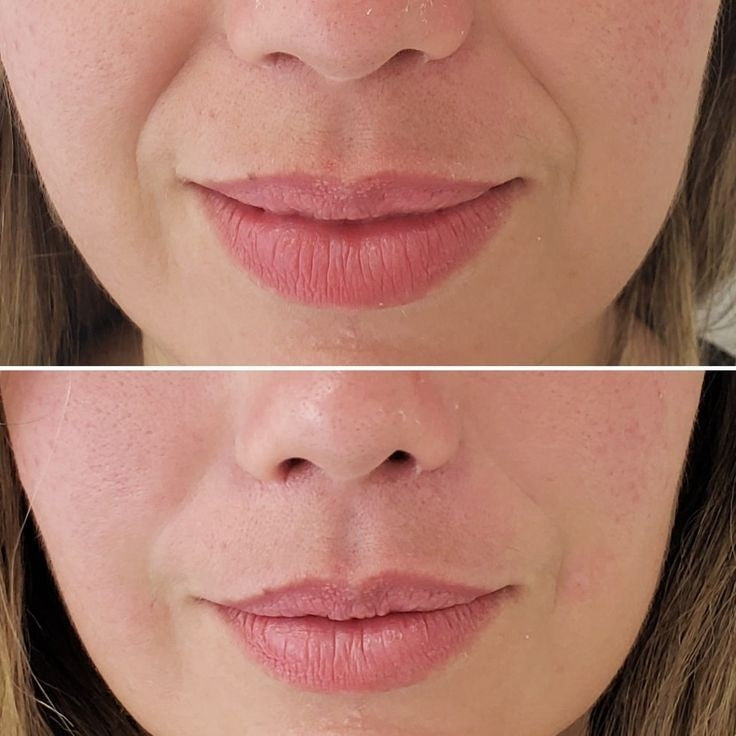 Retinal Booster Transforma tu piel con la nueva generación de retinol y colágeno