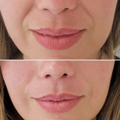 Retinal Booster Transforma tu piel con la nueva generación de retinol y colágeno