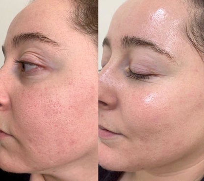 Crema Arencia Limpieza profunda, frescura total