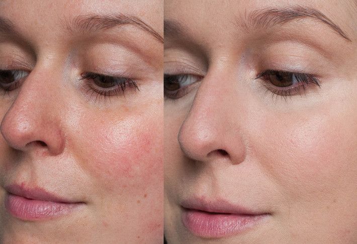 Serum Mediacube Rosa – Luminosidad y piel uniforme en cada gota