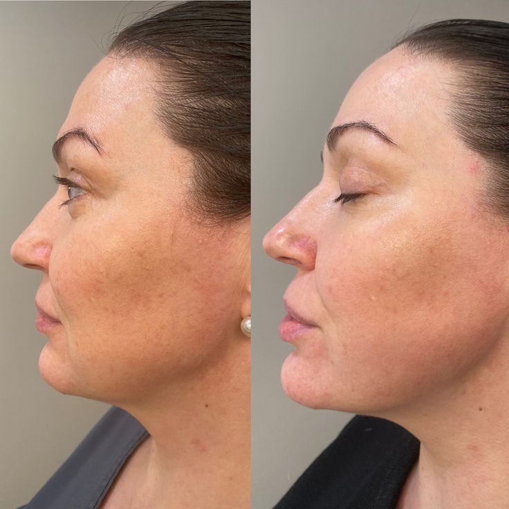 Silvetta BB Cream