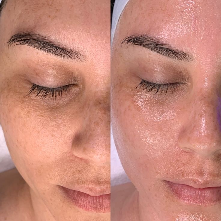 Crema Coreana NIDA - Fórmula Hidratante