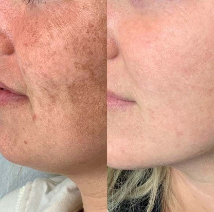 Crema Coreana NIDA - Fórmula Hidratante
