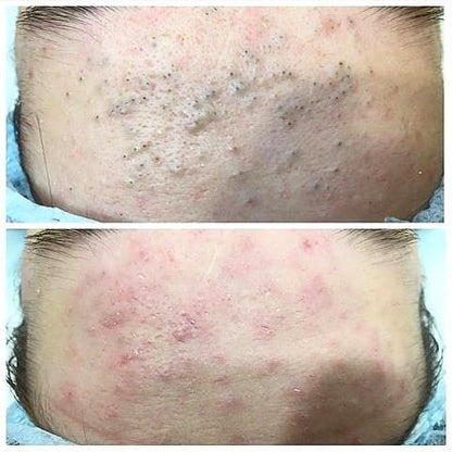 Mascarilla Joseon Brilla en 15 minutos