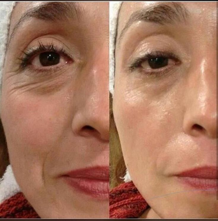 Bálsamo de colágeno - Rejuvenece tu piel y arrugas en semanas