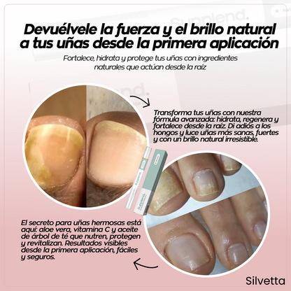Reparador de uñas con tecnología de Matriz