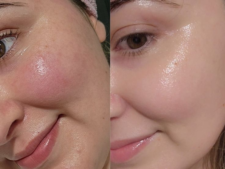 Eqqual Berry – Elasticidad y luminosidad avanzada
