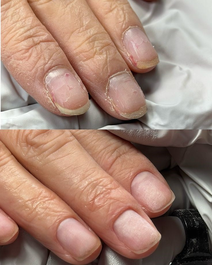 Reparador de uñas con tecnología de Matriz