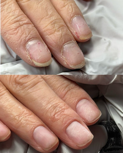 Reparador de uñas con tecnología de Matriz