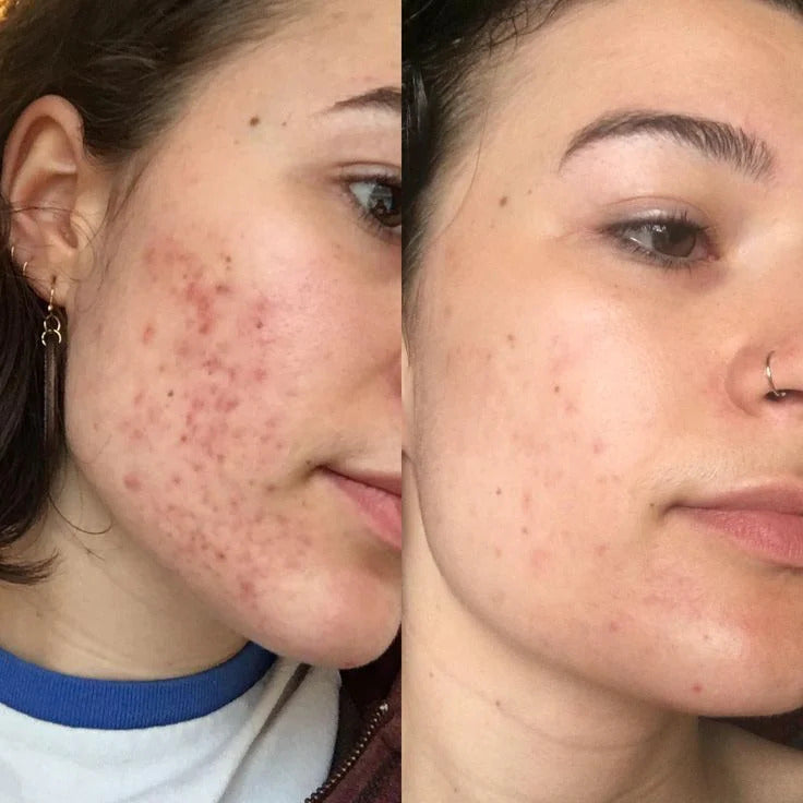 Retinal Booster Transforma tu piel con la nueva generación de retinol y colágeno
