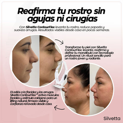 Silvetta ContourFlex Reductor De Papada