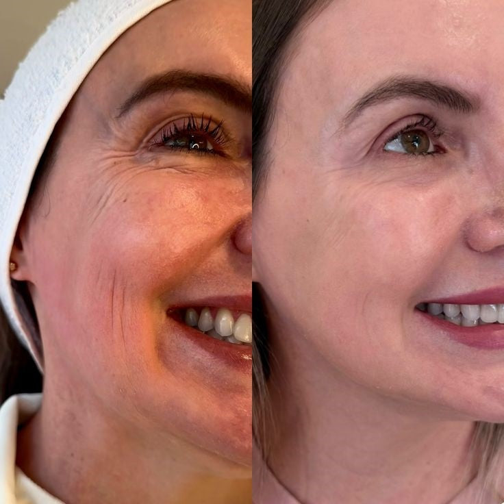 Mascarilla Magnetica Silvetta ELF Limpieza En Segundos