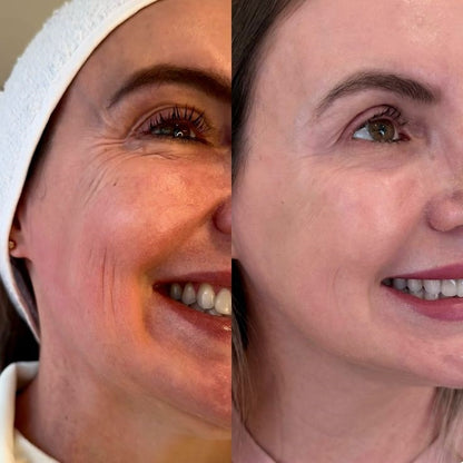 Mascarilla Magnetica Silvetta ELF Limpieza En Segundos