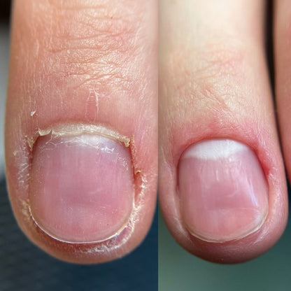 Reparador de uñas con tecnología de Matriz