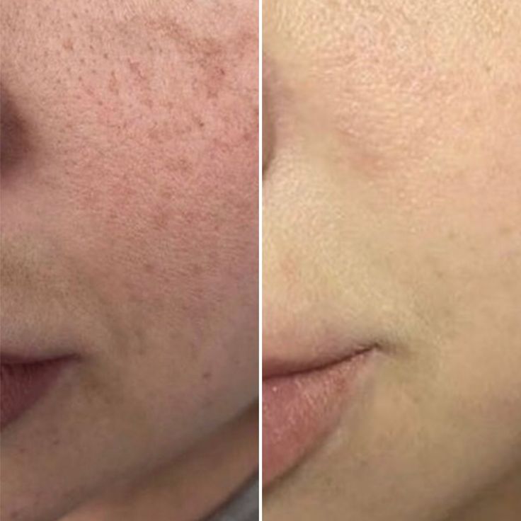 Crema Arencia Limpieza profunda, frescura total