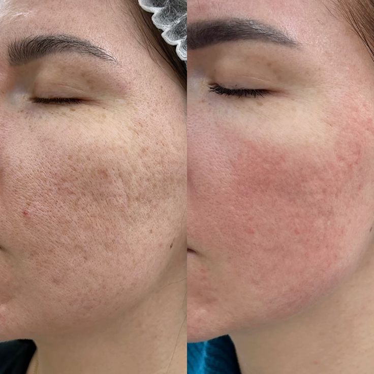Mascarilla Joseon Brilla en 15 minutos