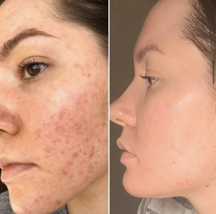 Crema Coreana NIDA - Fórmula Hidratante