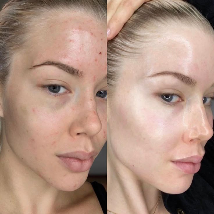 Silvetta BB Cream