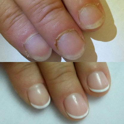 Reparador de uñas con tecnología de Matriz