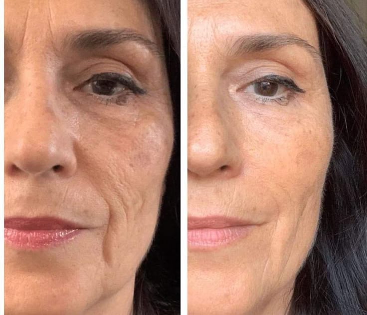 Bálsamo de colágeno - Rejuvenece tu piel y arrugas en semanas