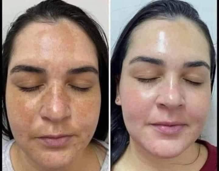 Serum Mediacube Rosa – Luminosidad y piel uniforme en cada gota