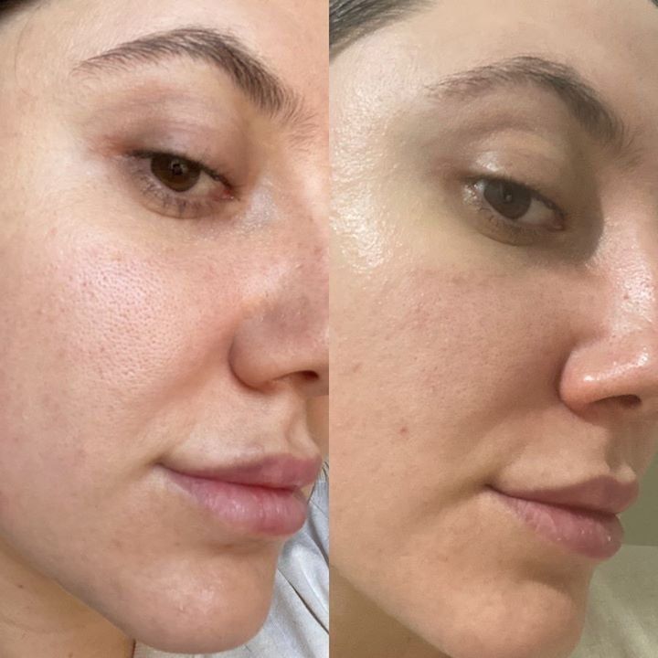 Serum de Centella – Hidratación y Reparación Intensiva