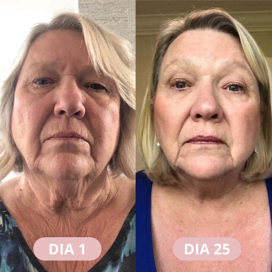 MASDERM SILVETTA Más firmeza. Más luminosidad. Más tú.