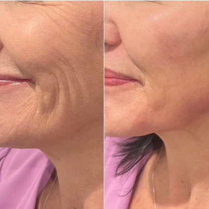 Silvetta Glow Duo La revolución en cuidado facial