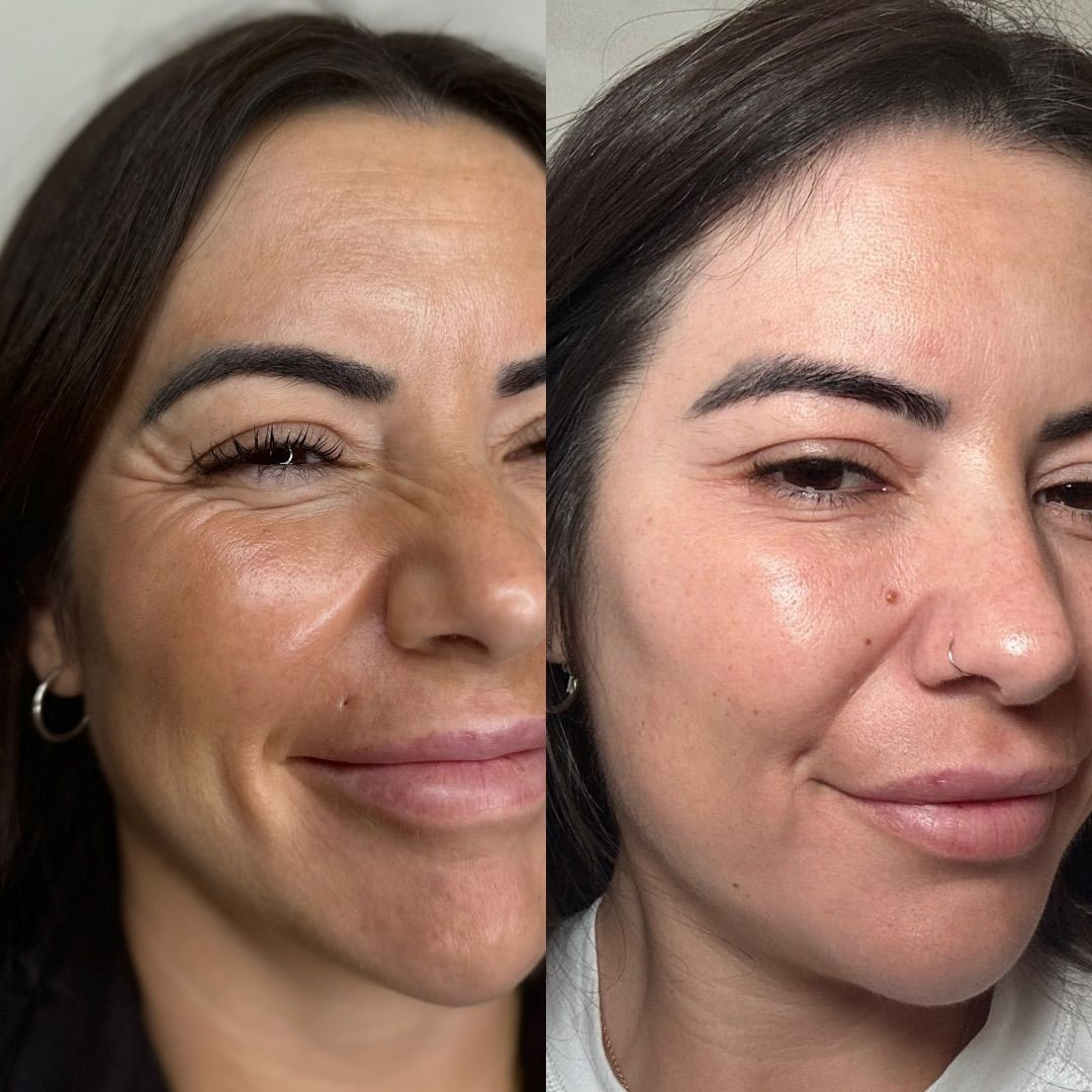 Silvetta Glow Duo La revolución en cuidado facial