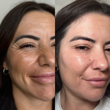 Silvetta Glow Duo La revolución en cuidado facial