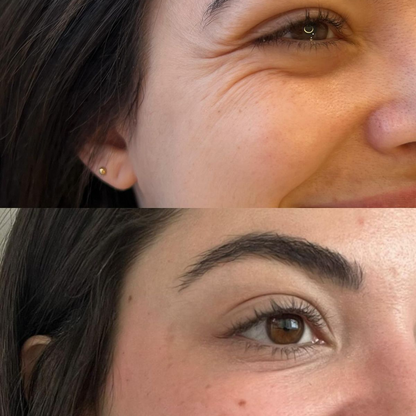 Silvetta Glow Duo La revolución en cuidado facial